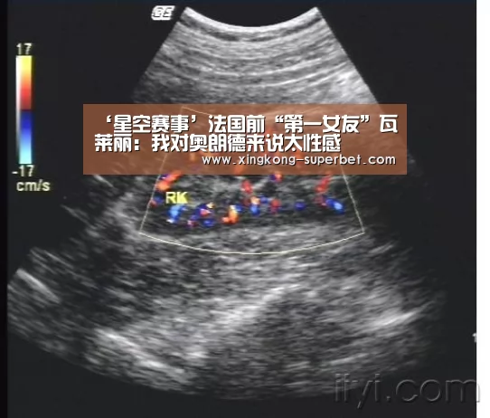 ‘星空赛事’法国前“第一女友”瓦莱丽:我对奥朗德来说太性感(图3) 星空官方